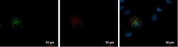 mCherry Antibody, Novus Biologicals 0.1mL:Antibodies, Polyclonal