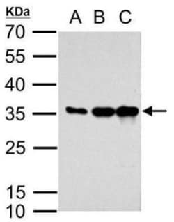 mCherry Antibody, Novus Biologicals 0.1mL:Antibodies, Polyclonal