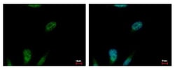 MCM3 Antibody, Novus Biologicals 0.1mg; Unlabeled:Antibodies, Polyclonal