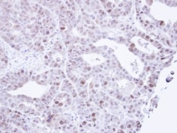 MCM3 Antibody, Novus Biologicals 0.1mg; Unlabeled:Antibodies, Polyclonal