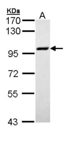MCM3 Antibody, Novus Biologicals 0.1mg; Unlabeled:Antibodies, Polyclonal