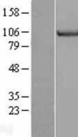 Novus Biologicals&trade;&nbsp;MCM3 Overexpression Lysate