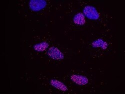 MCM3 Antibody, Novus Biologicals 0.1mL; Unlabeled:Antibodies, Polyclonal