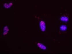 MCM5 Antibody, Novus Biologicals 0.1mL; Unlabeled:Antibodies, Polyclonal