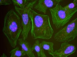 MCM6 Antibody, Novus Biologicals 0.1mg; Unlabeled:Antibodies, Polyclonal