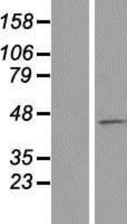 Novus Biologicals&trade;&nbsp;MCM9 Overexpression Lysate