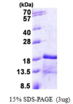 Novus Biologicals&trade;&nbsp;Recombinant Mouse CCL2/MCP1 His Protein
