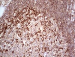 MCPH1 Antibody (OTI2A3), Novus Biologicals 0.1mL; Unlabeled:Antibodies,