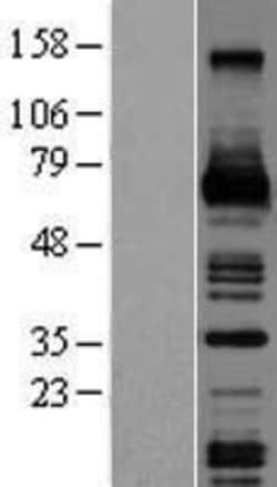 Novus Biologicals&trade;&nbsp;M-CSF Overexpression Lysate