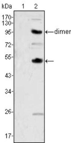 M-CSF Antibody (2D10), Novus Biologicals 0.1mL; Unlabeled:Antibodies, Monoclonal