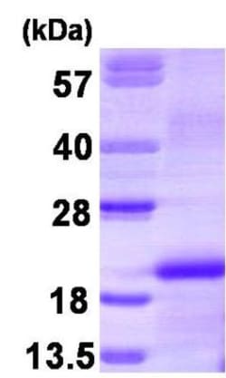 Novus Biologicals&trade;&nbsp;Recombinant Human M-CSF His Protein