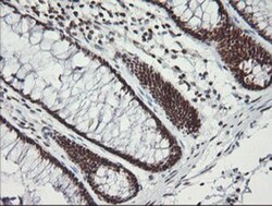 MCTS1 Antibody (OTI2F9), Novus Biologicals 0.1mL; Unlabeled:Antibodies,