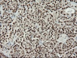 MCTS1 Antibody (OTI2F9), Novus Biologicals 0.1mL; Unlabeled:Antibodies,