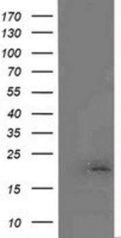 MCTS1 Antibody (OTI2F9), Novus Biologicals 0.1mL; Unlabeled:Antibodies,