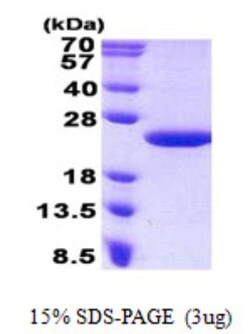 Novus Biologicals&trade;&nbsp;Recombinant Human MCTS1 His Protein