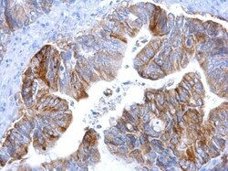 MCT1/SLC16A1 Antibody (14612), Novus Biologicals 0.1mL; Unlabeled:Antibodies,
