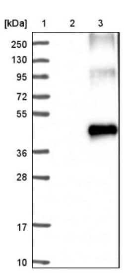 MCT2 Antibody, Novus Biologicals 0.1mL; Unlabeled:Antibodies, Polyclonal