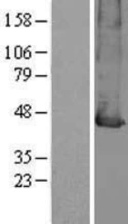 Novus Biologicals&trade;&nbsp;MCT2 Overexpression Lysate