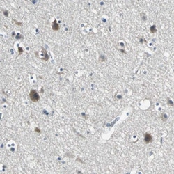 MCT2 Antibody, Novus Biologicals 0.1mL; Unlabeled:Antibodies, Polyclonal