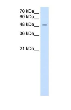 MCT3/SLC16A8 Antibody, Novus Biologicals 100 &mu;L | Buy Online | Novus Biologicals | Fisher Scientific