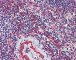 MCTP1 Antibody, Novus Biologicals 0.05mg; Unlabeled:Antibodies, Polyclonal