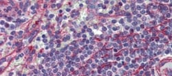 MCTP1 Antibody, Novus Biologicals 0.05mg; Unlabeled:Antibodies, Polyclonal