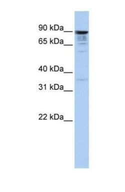 MCTP1 Antibody, Novus Biologicals 0.05mg; Unlabeled:Antibodies, Polyclonal