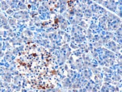 MDA5 Antibody, Novus Biologicals 0.1mg; Unlabeled:Antibodies, Polyclonal