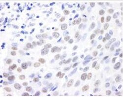 MDC1 Antibody, Novus Biologicals 0.1mL; Unlabeled:Antibodies, Polyclonal