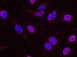 MDC1 Antibody, Novus Biologicals 0.1mL; Unlabeled:Antibodies, Polyclonal