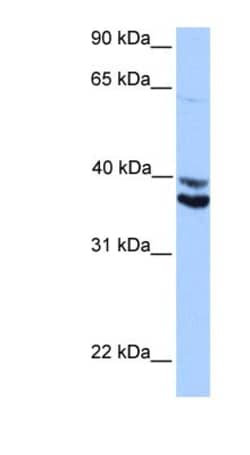 MDFIC Antibody, Novus Biologicals 100&mu;L; Unlabeled:Antibodies, Polyclonal