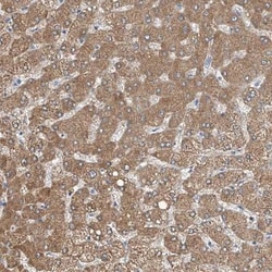 MDGA1 Antibody, Novus Biologicals 25 &mu;L, Unlabeled:Antibodies, Polyclonal