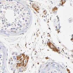 MDGA2 Antibody, Novus Biologicals:Antibodies:Primary Antibodies