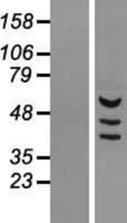 Novus Biologicals™ MDH1B Overexpression Lysate