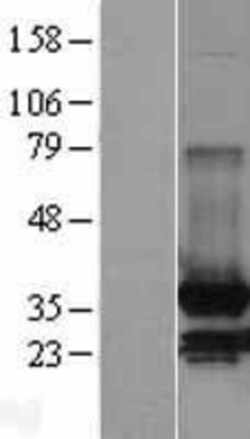 Novus Biologicals™ MDH2 Overexpression Lysate