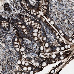 MDH2 Antibody, Novus Biologicals 25 &mu;L; Unlabeled:Antibodies, Polyclonal