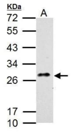 MDL-1/CLEC5A Antibody, Novus Biologicals 0.1mL:Antibodies, Polyclonal