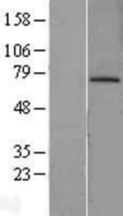 Novus Biologicals&trade;&nbsp;MDM2/HDM2 Overexpression Lysate