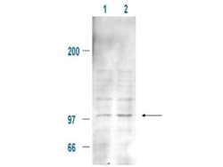 MDM2/HDM2, p Ser185 Antibody, Novus Biologicals 0.1mg; Unlabeled:Antibodies,