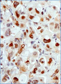 MDM2/HDM2 Antibody (SMP14) - BSA Free, Novus Biologicals:Antibodies:Primary