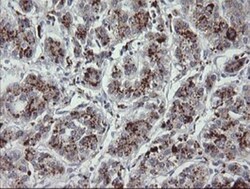 MDMX Antibody (OTI4G5), Novus Biologicals 0.1mL; Unlabeled:Antibodies,