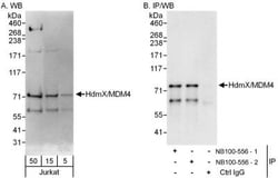 MDMX Antibody, Novus Biologicals 0.1mg; Unlabeled:Anticorps, Polyclonal