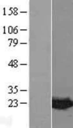 Novus Biologicals&trade;&nbsp;MDP1 Overexpression Lysate