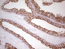 MDR1/ABCB1 Antibody (OTI1A7), Novus Biologicals 0.1mL; Unlabeled:Antibodies,