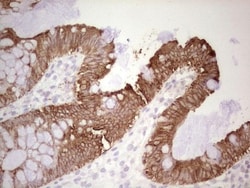 MDR1/ABCB1 Antibody (OTI1A7), Novus Biologicals 0.1mL; Unlabeled:Antibodies,