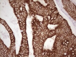 MDR1/ABCB1 Antibody (OTI1A7), Novus Biologicals 0.1mL; Unlabeled:Antibodies,