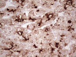MDR1/ABCB1 Antibody (OTI1A7), Novus Biologicals 0.1mL; Unlabeled:Antibodies,