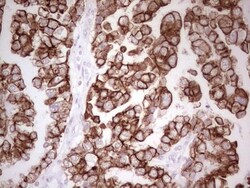 MDR1/ABCB1 Antibody (OTI1A7), Novus Biologicals 0.1mL; Unlabeled:Antibodies,