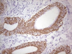 MDR1/ABCB1 Antibody (OTI1A7), Novus Biologicals 0.1mL; Unlabeled:Antibodies,