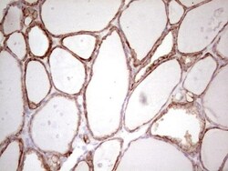 MDR1/ABCB1 Antibody (OTI1A7), Novus Biologicals 0.1mL; Unlabeled:Antibodies,